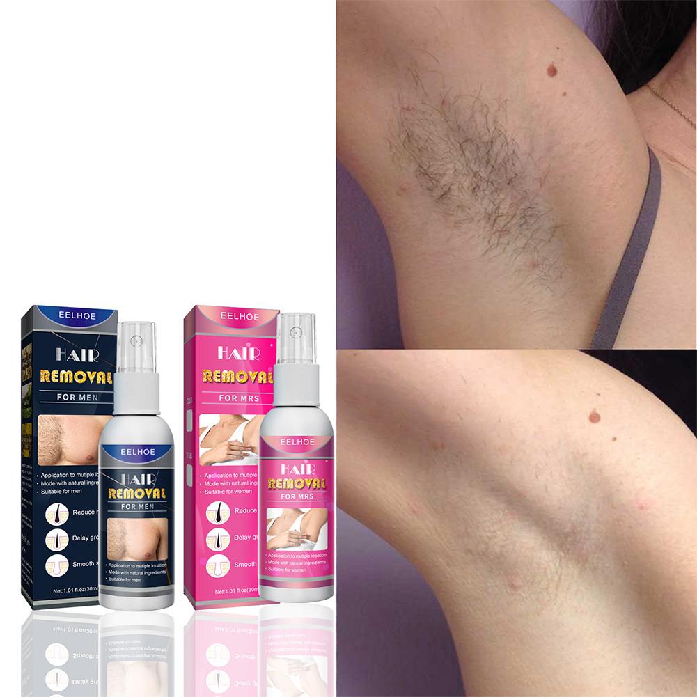 1/2 Uds. Depiladora permanente - Women Accessories Clearance reseña y precio
